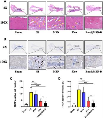 A Bone-Targeting Enoxacin Delivery System to Eradicate Staphylococcus Aureus-Related Implantation Infections and Bone Loss